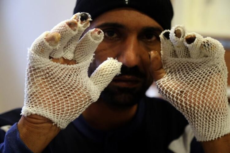 Karlar eridiğinde kaç ceset sayacağız?